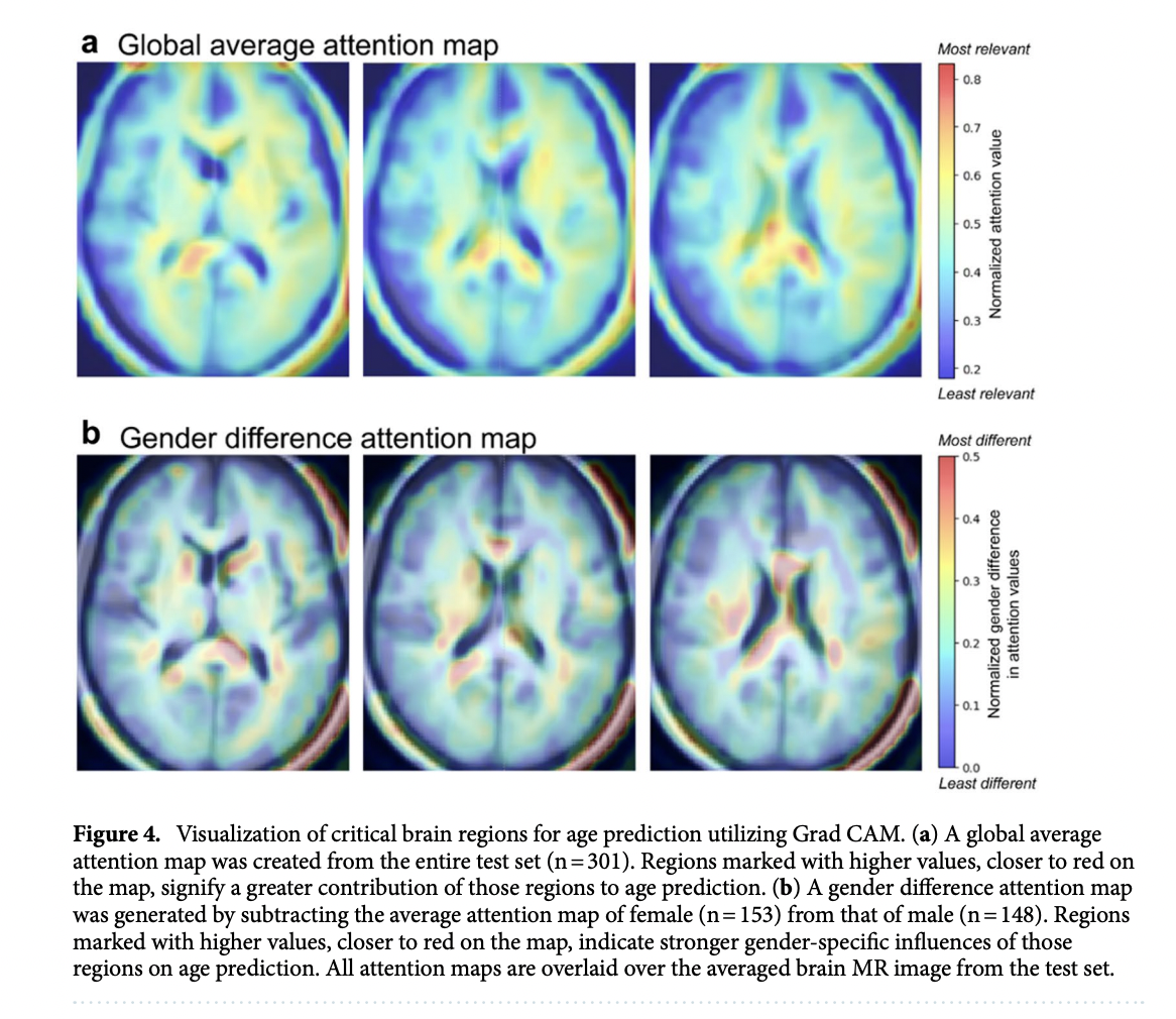 This AI Research Unveils a Deep Convolutional Neural Network CNN-MLP Algorithm for Enhanced Brain Age Prediction: A Game-Changer in Neurodegenerative Disease Prognosis